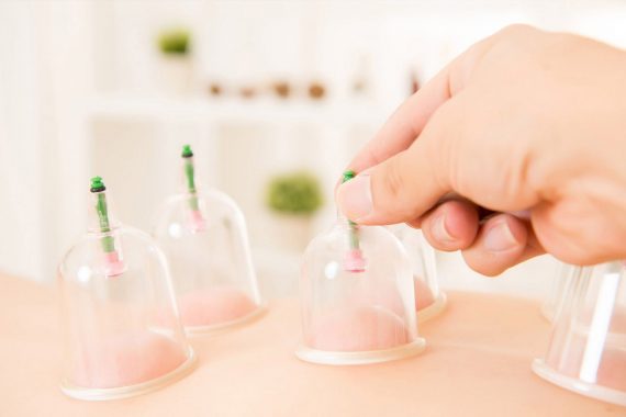 Лечение кровопусканием (хиджама) Лечение кровопусканием (хиджама)