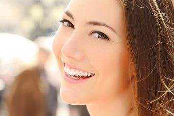 Голливудская улыбка