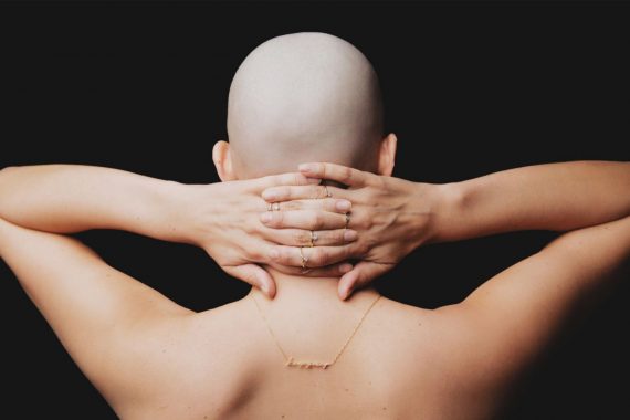 Return To Life After Oncology Return To Life After Oncology