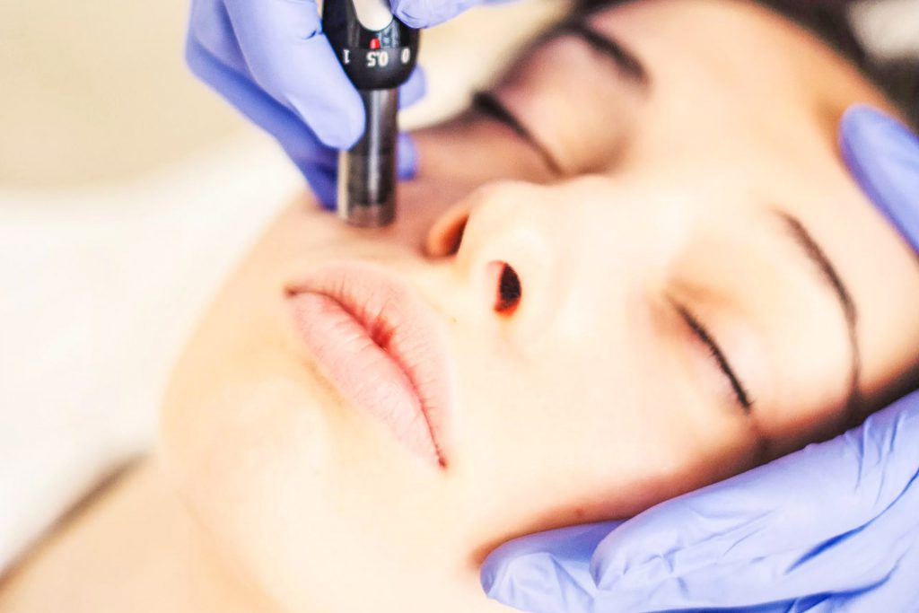 Dermapen TM