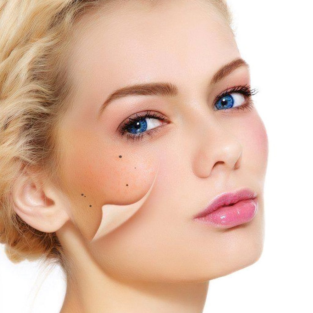 Dermapen TM