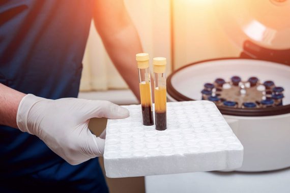 Mesotherapy Treatment (Meso Gun Therapy) in Turkey