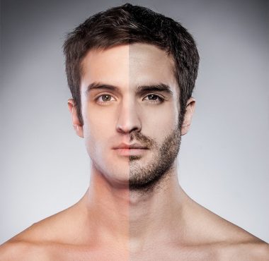 Hair & Bearc Transplant - Medworld Clinic Hair & Bearc Transplant - Medworld Clinic