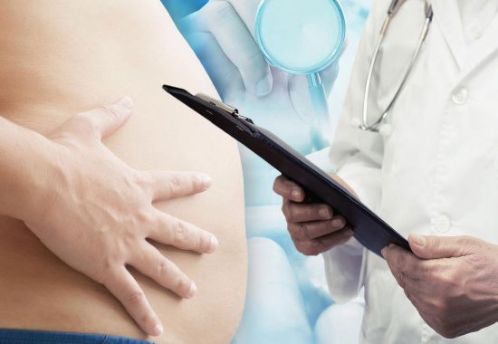 liposuction liposuction