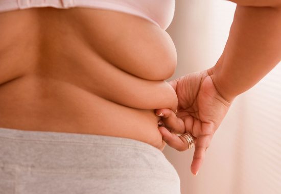 Sleeve Gastric Surgery Sleeve Gastric Surgery