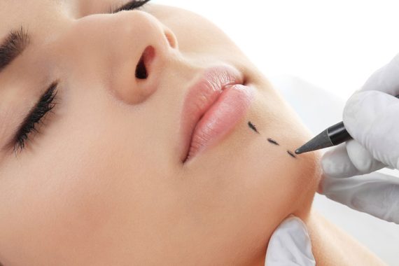 chin surgery / sliding genioplasty surgery procedure in Turkey